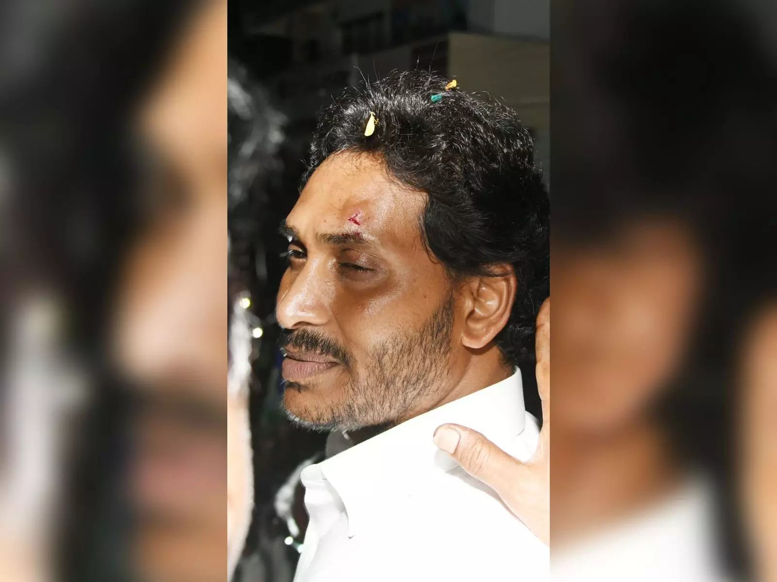 YS Jagan attacked in Memantha Siddham Yatra in Vijayawada, CM continues yatra after first aid